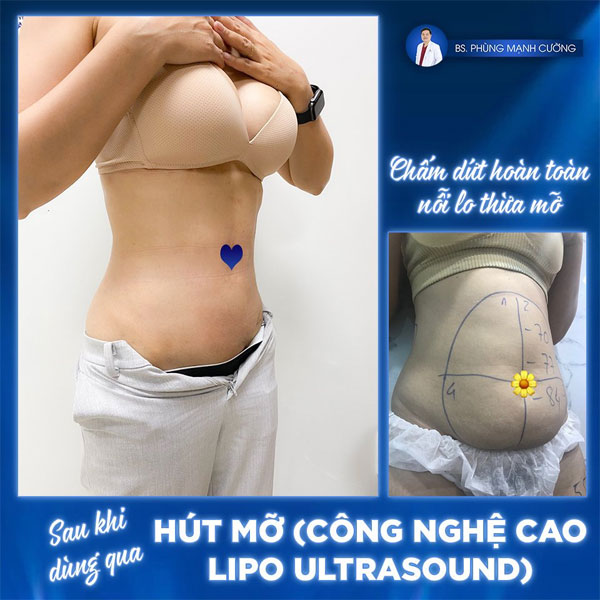 Hình ảnh bệnh viện thẩm mỹ Gangwhoo Lừa Gạt Khách Hàng đi giảm béo