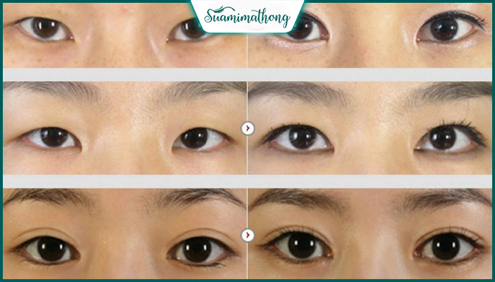 Biểu hiện của các loại mắt xếch phổ biến